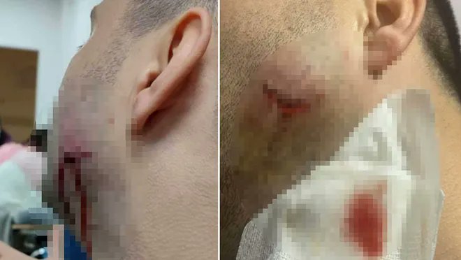 Sağlık personeline saldıran jandarma açığa alındı