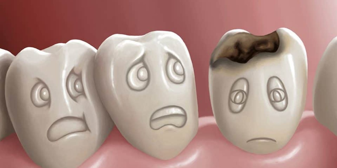 Çocuklarda ağız kokusunun en önemli nedeni çürük dişler! Vitamin eksikliği de ağız kokusu yapabiliyor!