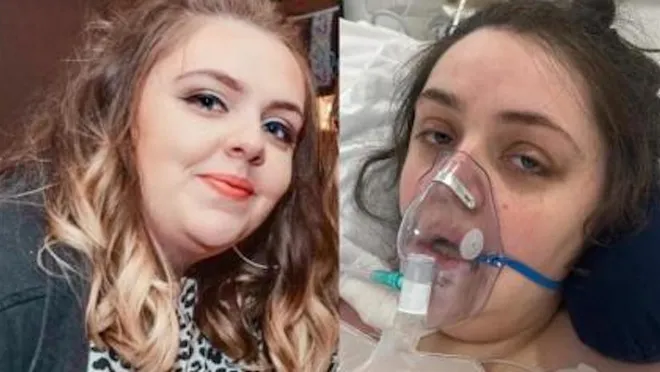 Türkiye'de mide küçültme ameliyatı olan İngiliz kadın, komaya girdi