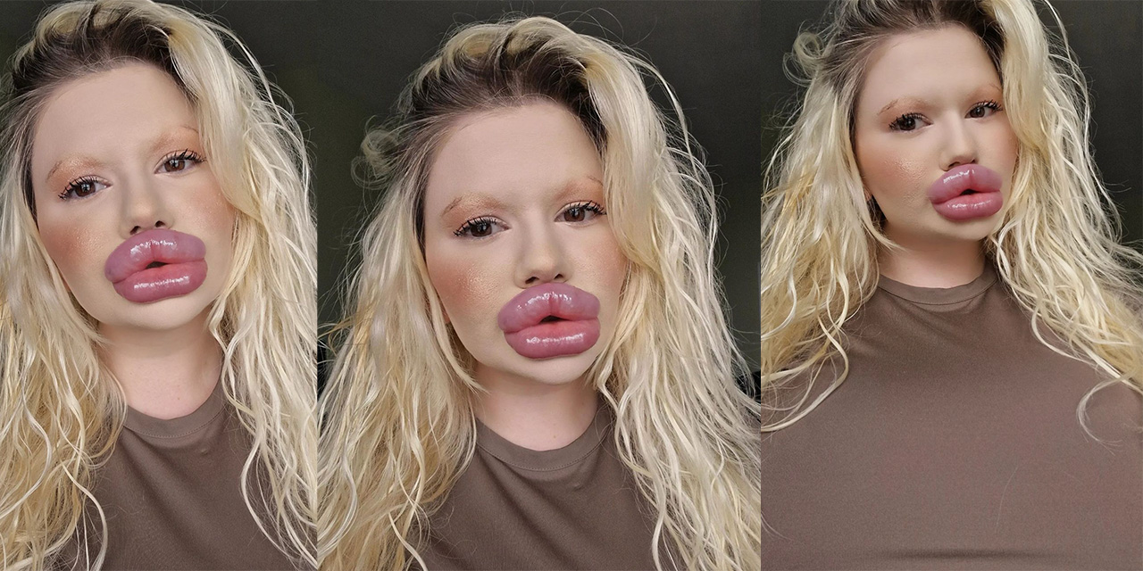 32 ameliyat sonrası 'Dünyanın En Büyük Dudaklı Kadını' olan Andrea Ivanova yeni hedefini açıkladı