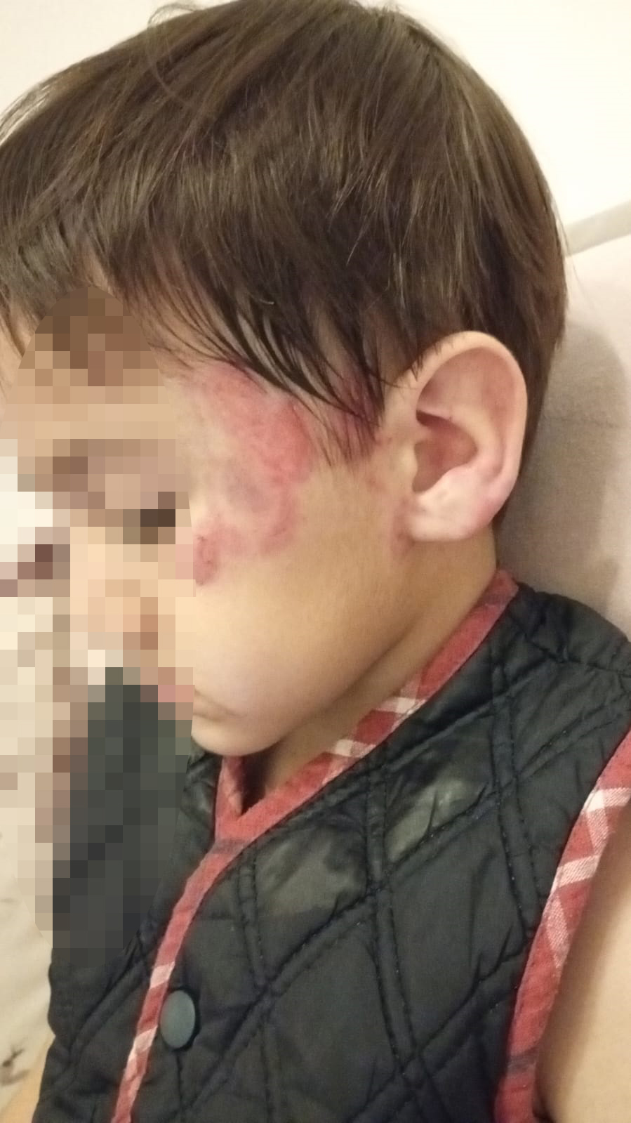 Anaokulunda uyku saatinde arkadaşının 13 yerini ısırdı