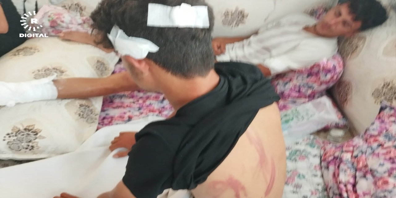 Muğla’da Mardinli 4 Kürt işçiye saldırıldı