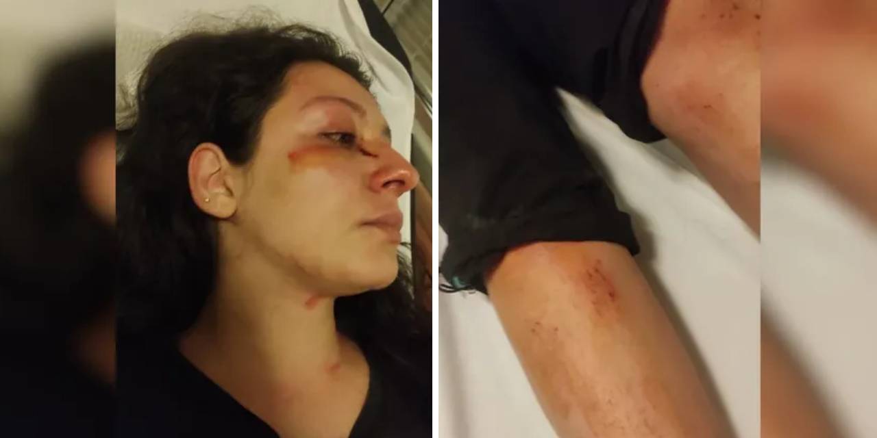 Sokak hayvanlarını besleyen anne ve kızı komşularının saldırısına uğradı