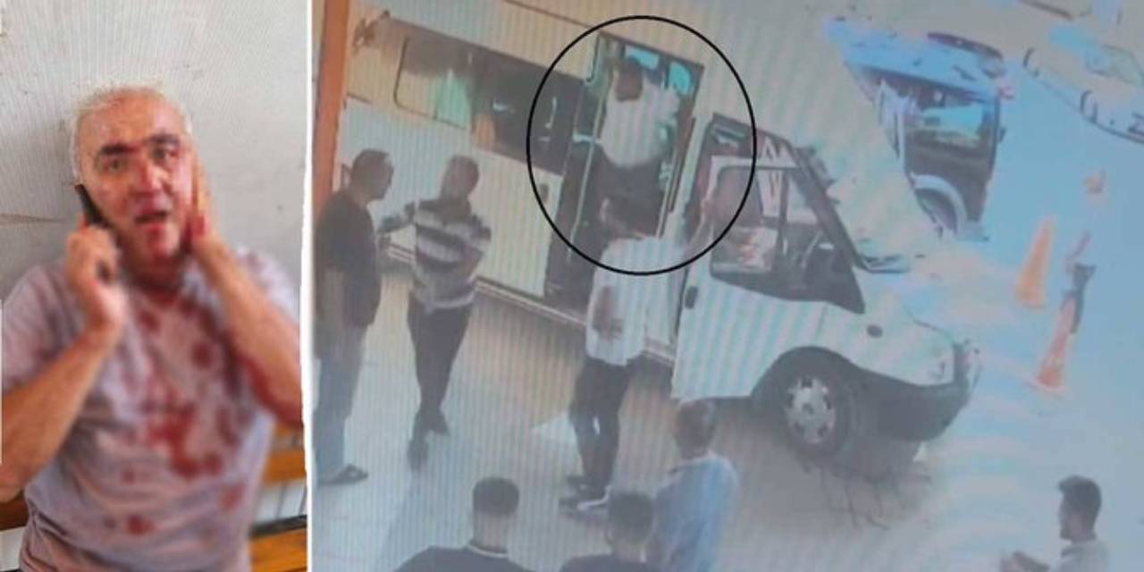 Hatay'da kavga ettiği minibüs şoförünün kulağını ısırarak kopardı