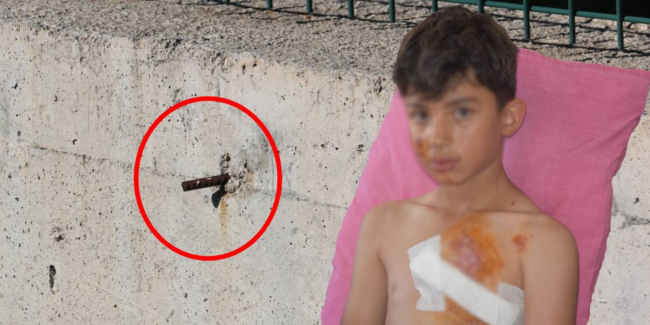 Açıkta duran inşaat demiri düşen çocuğun göğsüne saplandı