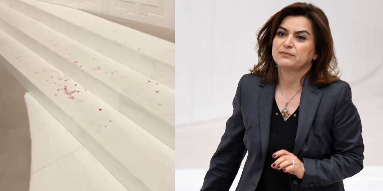 Mecliste yumruklu kavgada yaralanan DEM Partili Koçyiğit: Planlıydı, ekipleri ayarlamışlardı