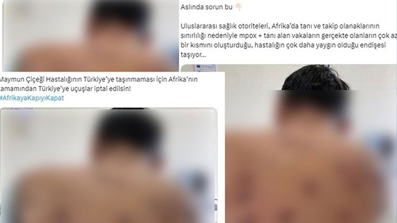 DMM'den 'maymun çiçeği' paylaşımlarına yalanlama geldi