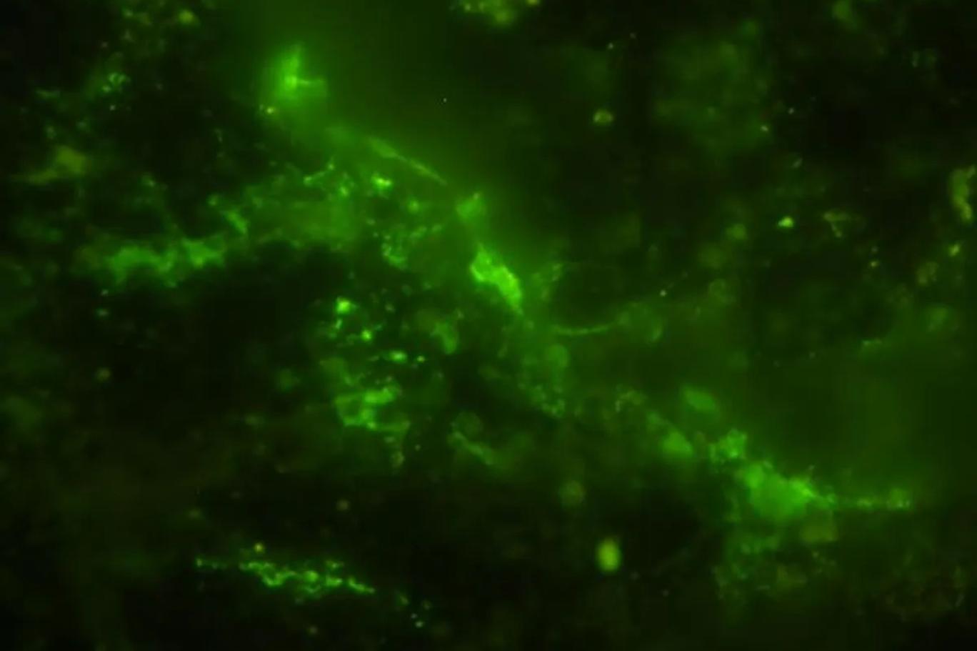 Bilim insanları dünyanın en eski mikroplarını buldu