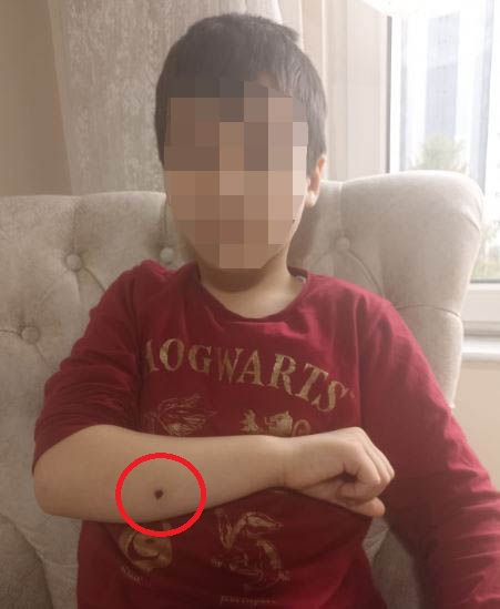 Fırındaki çatışmada kolundan yaralanan çocuk: Olayın şoku ile donup kaldım