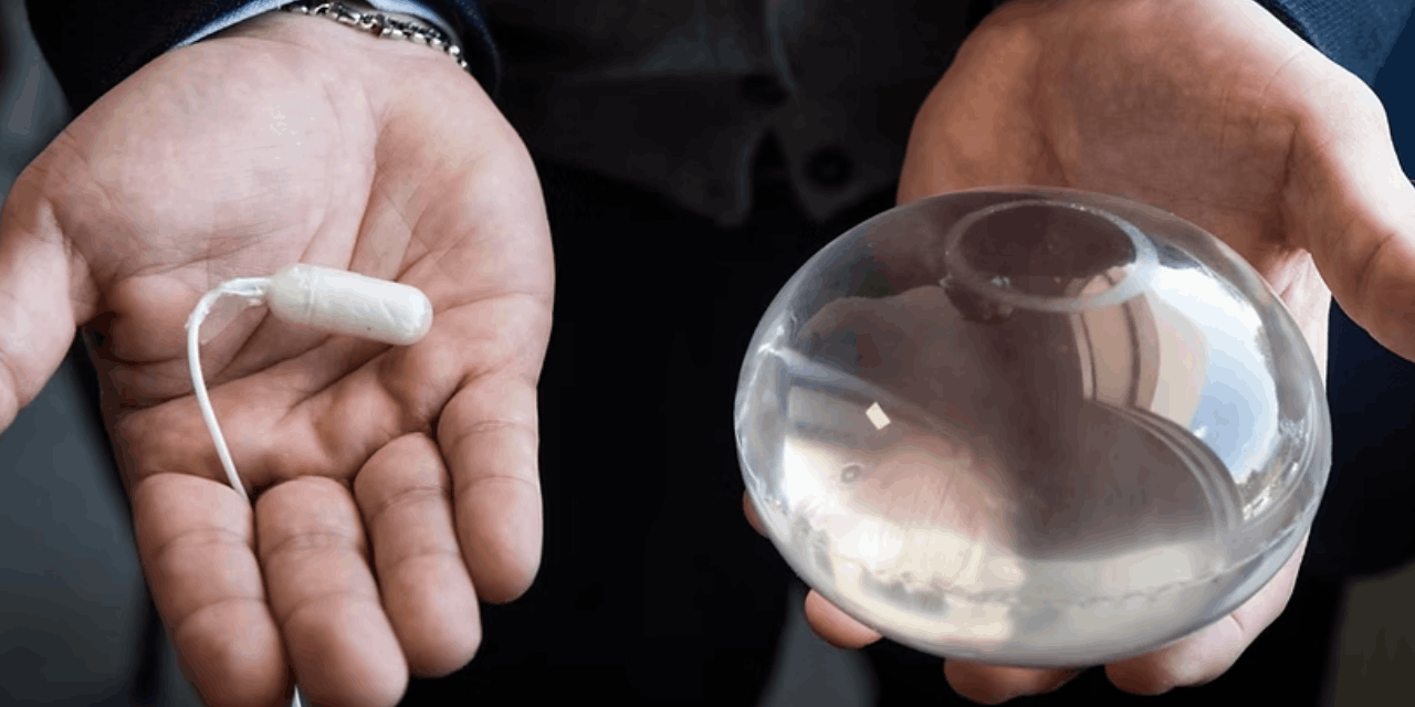 Yutulabilir mide balonları Avrupa’da yasaklandı, Türkiye de uygulamayı durdurdu