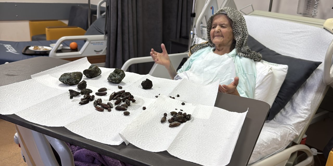 Zeytin ve hurma çekirdeği yutan 92 yaşındaki vatandaş ameliyat oldu