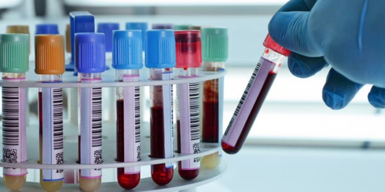 İstanbul İl Sağlık Müdürlüğü kabul etti: Kan örnekleri kuryelerle taşındı, bazıları kayboldu!