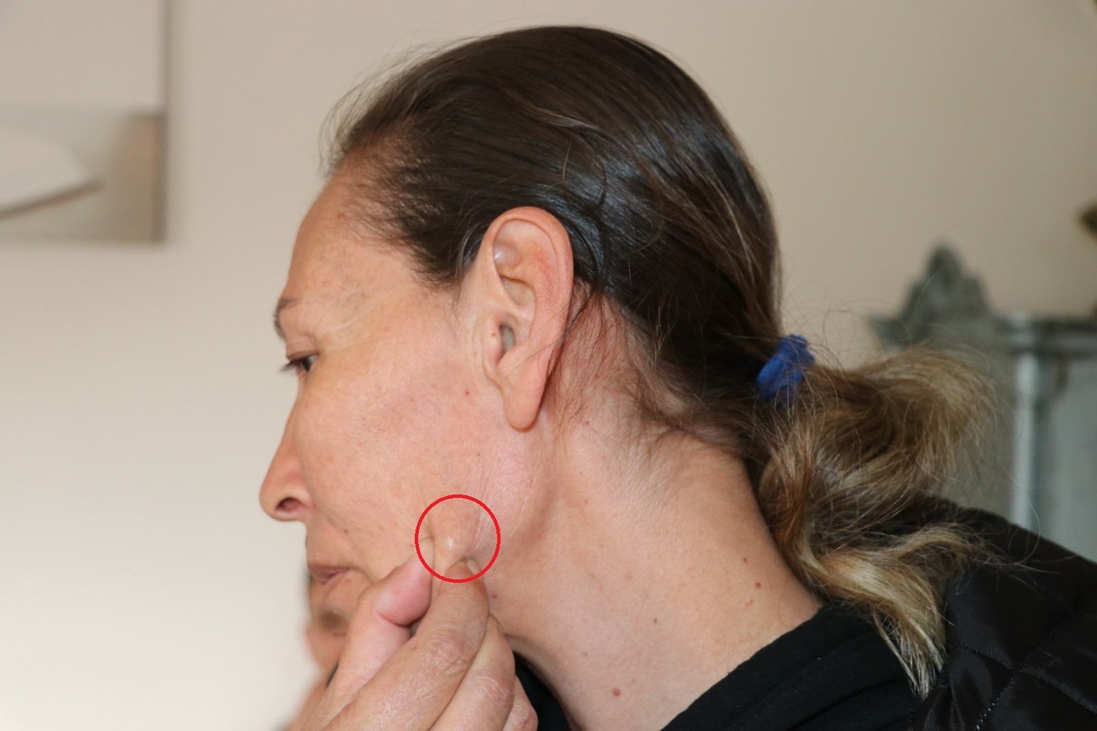 Şarkıcı Işık'ın karıştığı komşu kavgasında yaralanan Yusuf: Vücudumda saçmalar hala duruyor