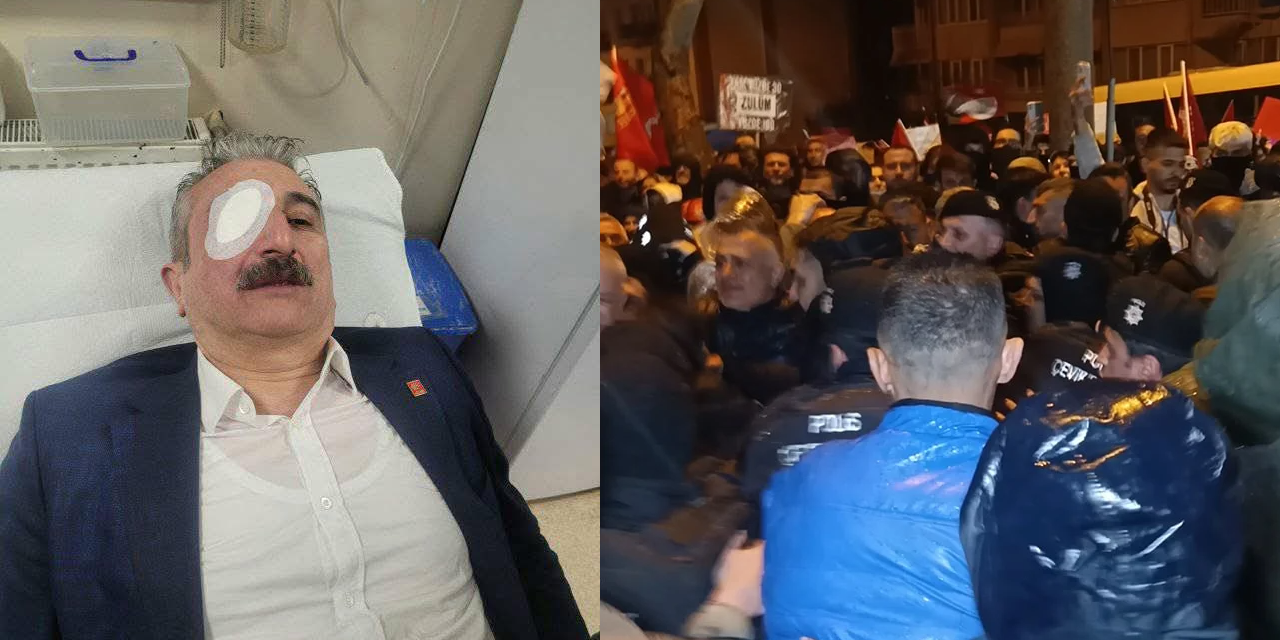 Gözünden yaralanmıştı: CHP Bursa İl Başkanı Nihat Yeşiltaş’ın son durumu