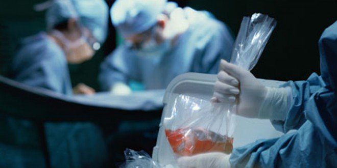 Organ nakli alanında umut verici adım: Bir hastaya genetiği değiştirilmiş domuz böbreği nakledildi