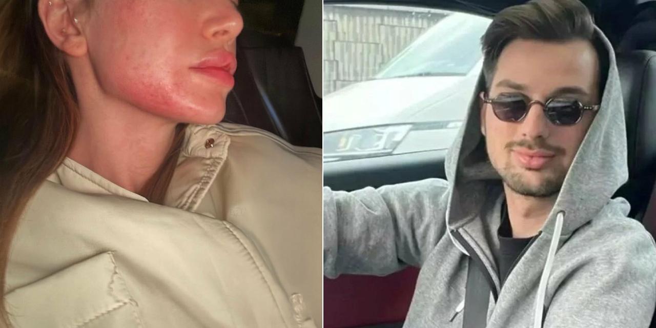 Sosyal medya ünlüsü 'Danla Bilic’i darbeden Berk Çetin tutuklandı