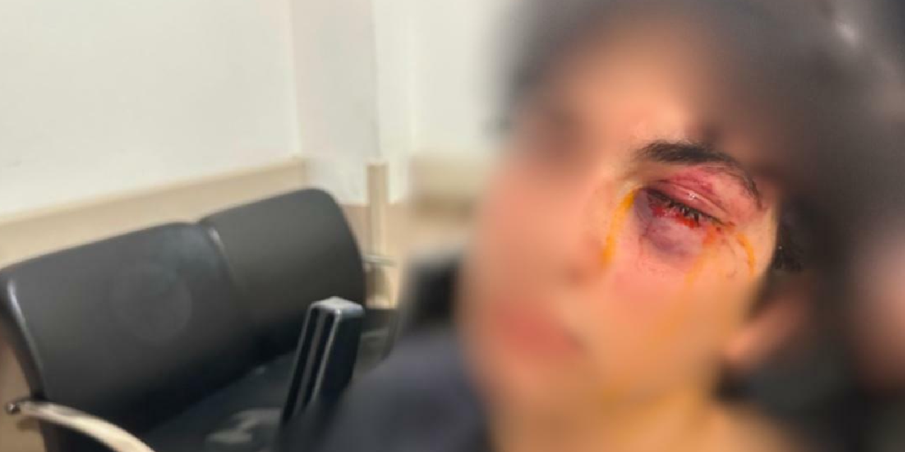 15 yaşındaki çocuğu öldüresiye dövdüler! İstanbul'da CHP standına saldırı