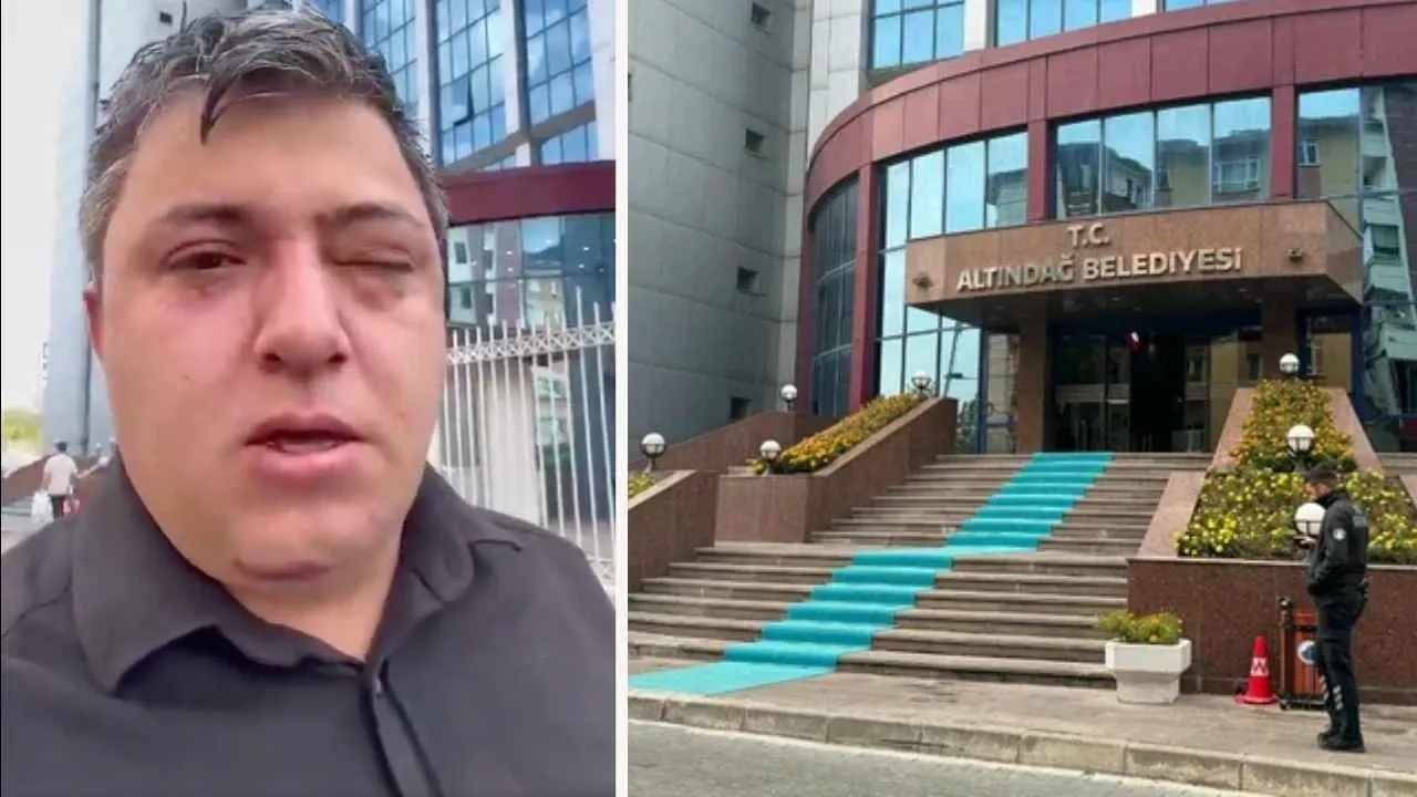 Altındağ Belediyesi’nde çalışan işçi: Başkan ve yardımcıları tarafından dövüldüm