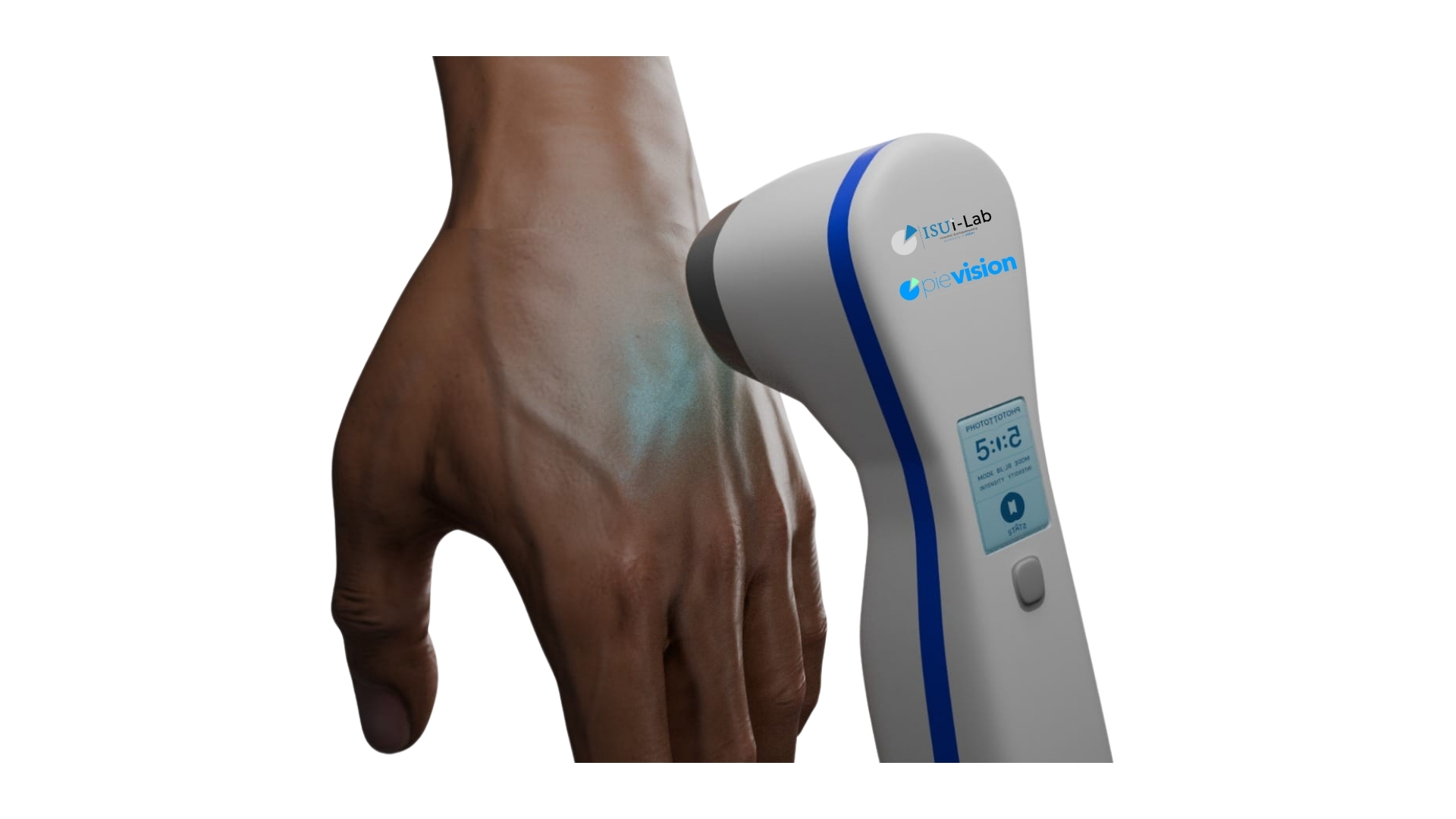 Üniversite öğrencisi, Vitiligo tedavisi İçin inovatif cihaz geliştirdi