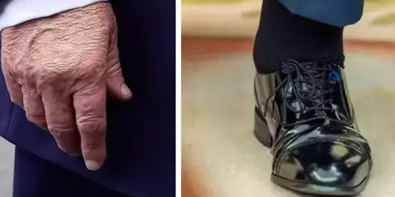 Trump ciddi bir sağlık sorunu mu yaşıyor: Doktor raporu çıktı