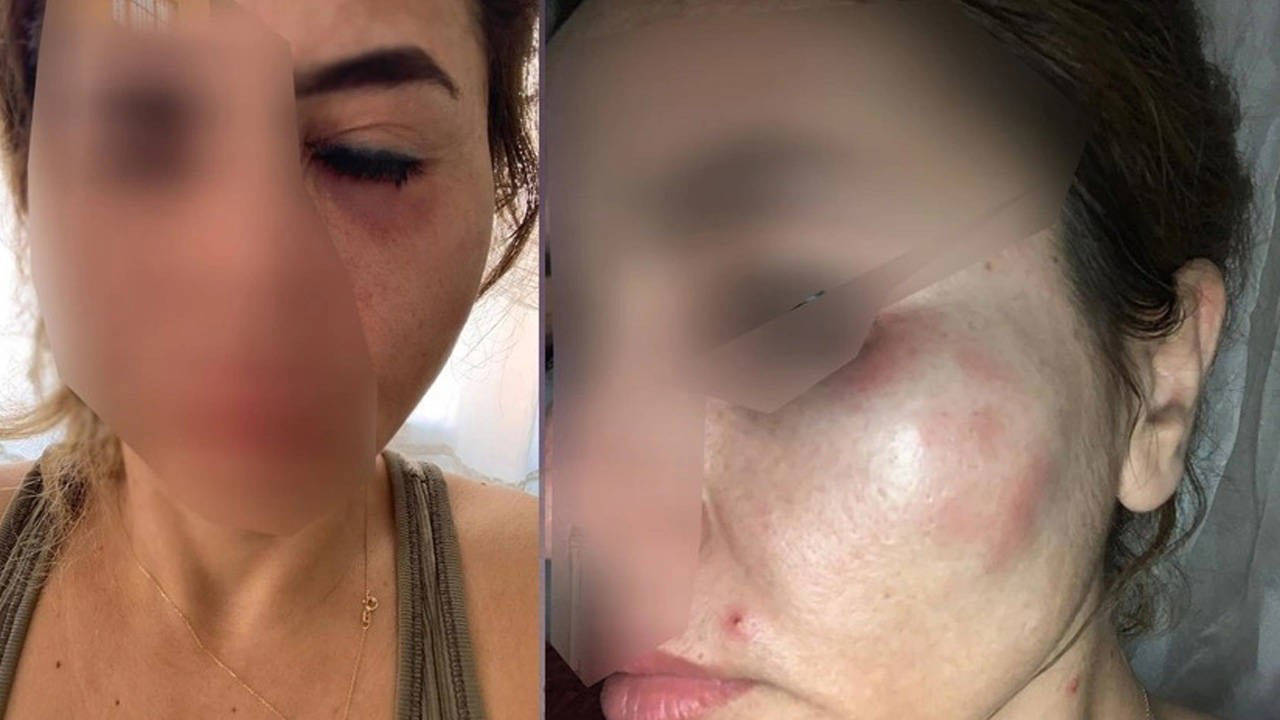 Öğretmene yumruk atmıştı: MHP'liye ödül gibi ceza