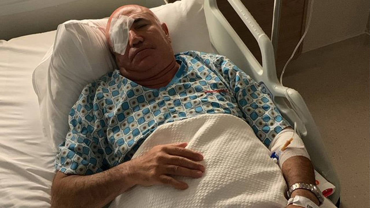 Mahmut Tanal, polis müdahalesi sırasında gözünden yaralandı