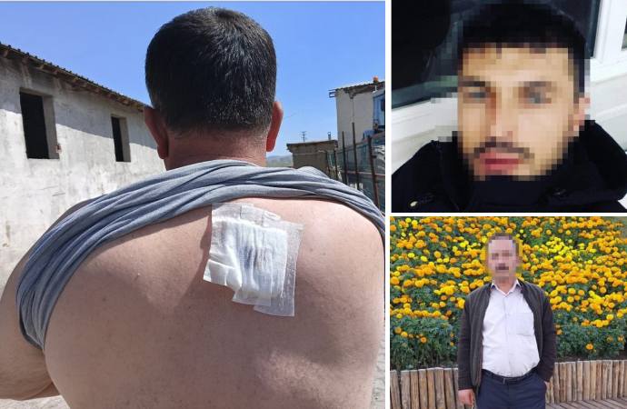 Ankara’da rakip muhtarların arasında kavga çıktı: 23 yaralı