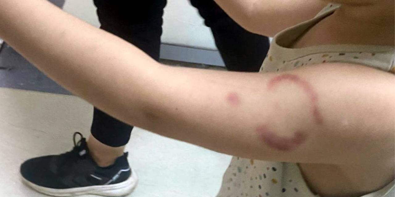 Edirne bu olayı konuşuyor: ‘Isırıkçı öğretmen’