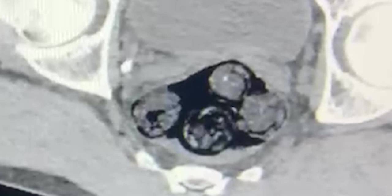 Iğdır'da uyuşturucu taşıyan yabancı uyruklu kişi yakalandı