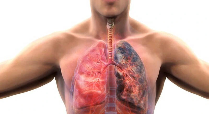 Elektronik sigara masum değil: Araştırmalar KOAH tehlikesini gözler önüne seriyor