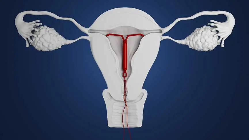 Danimarka, rızası olmadan spiral takılan 4 bin 500 kadına tazminat ödeyecek