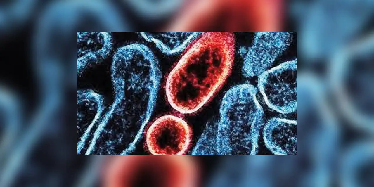 Yarasalardan bulaşan "Nipah virüsü" yeni bir pandemiye neden olur mu?