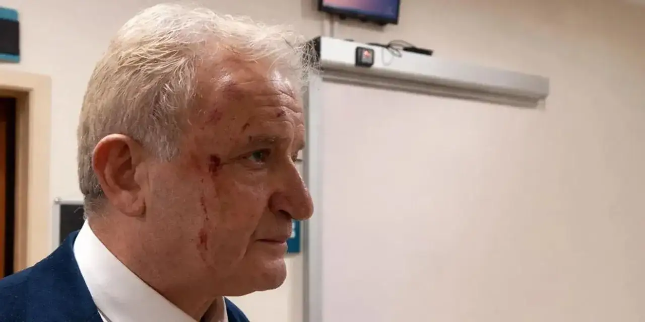 Gazeteciye yumruklu saldırı: CHP ve AK Parti’den tepkiler