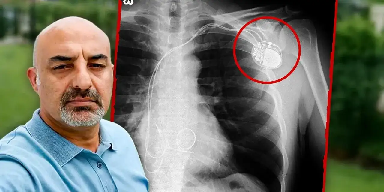 İBB tutuklusu Bildik'in hayati tehlikesi var: Cezaevinde kalp pili kaydı, avukatları uyardı