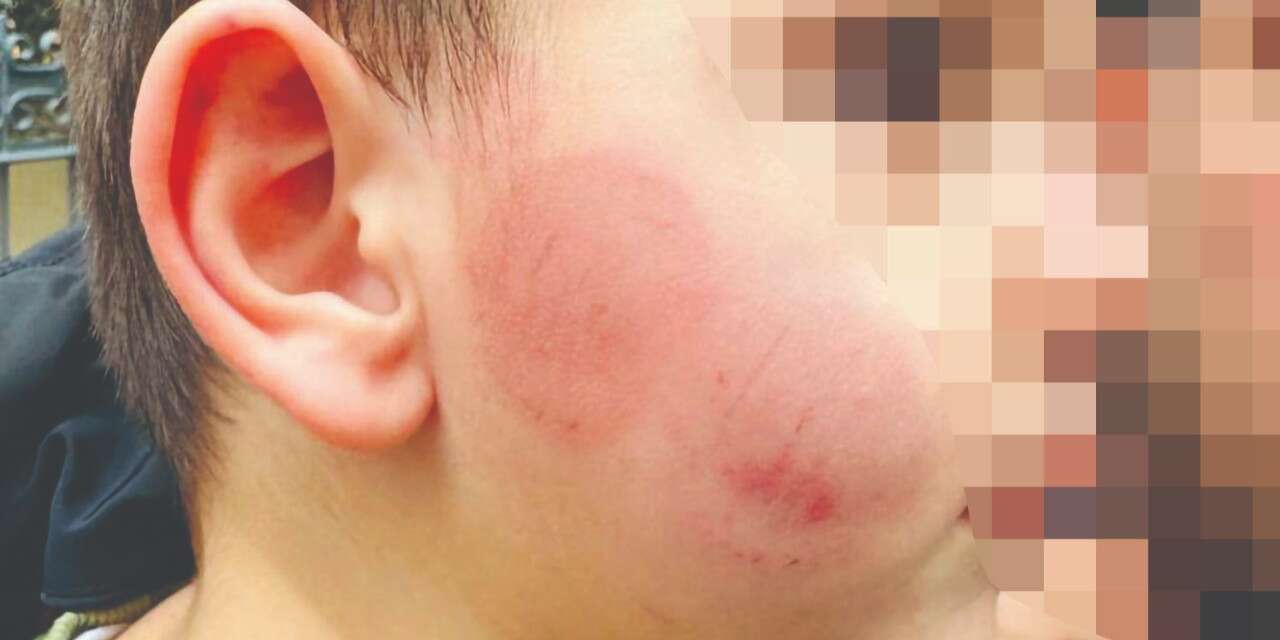 3 yaşındaki çocuğa kreşte darp