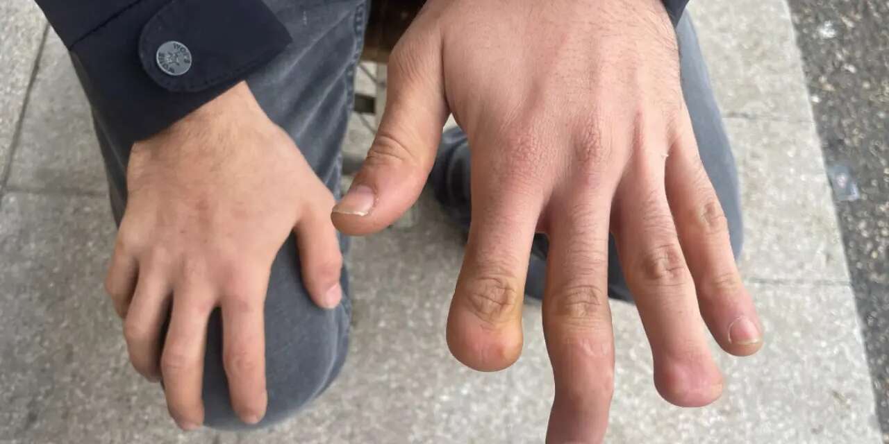 Patron işçiyi suçladı: Parmağını bilerek soktu!