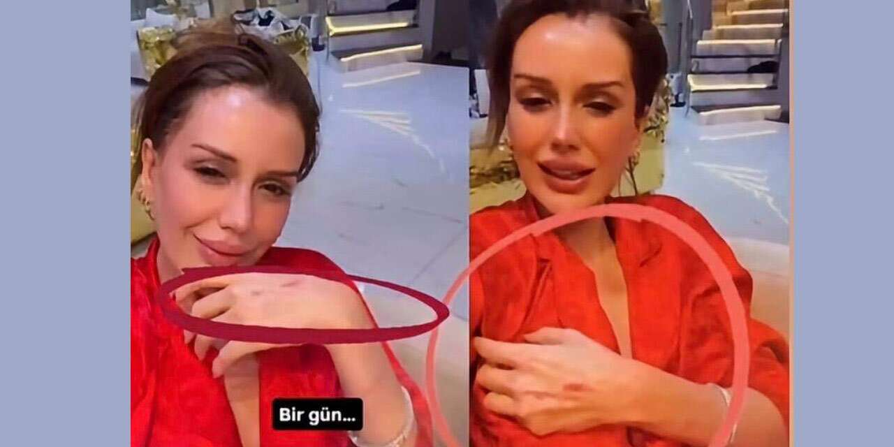 Dilan Polat son videosundaki ayrıntıdan sonra hesabını kapattı