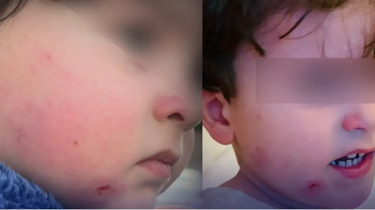 Gemlik’te özel kreşte bir çocuk darp edildi: Her şey iki dakika içinde oldu savunması…