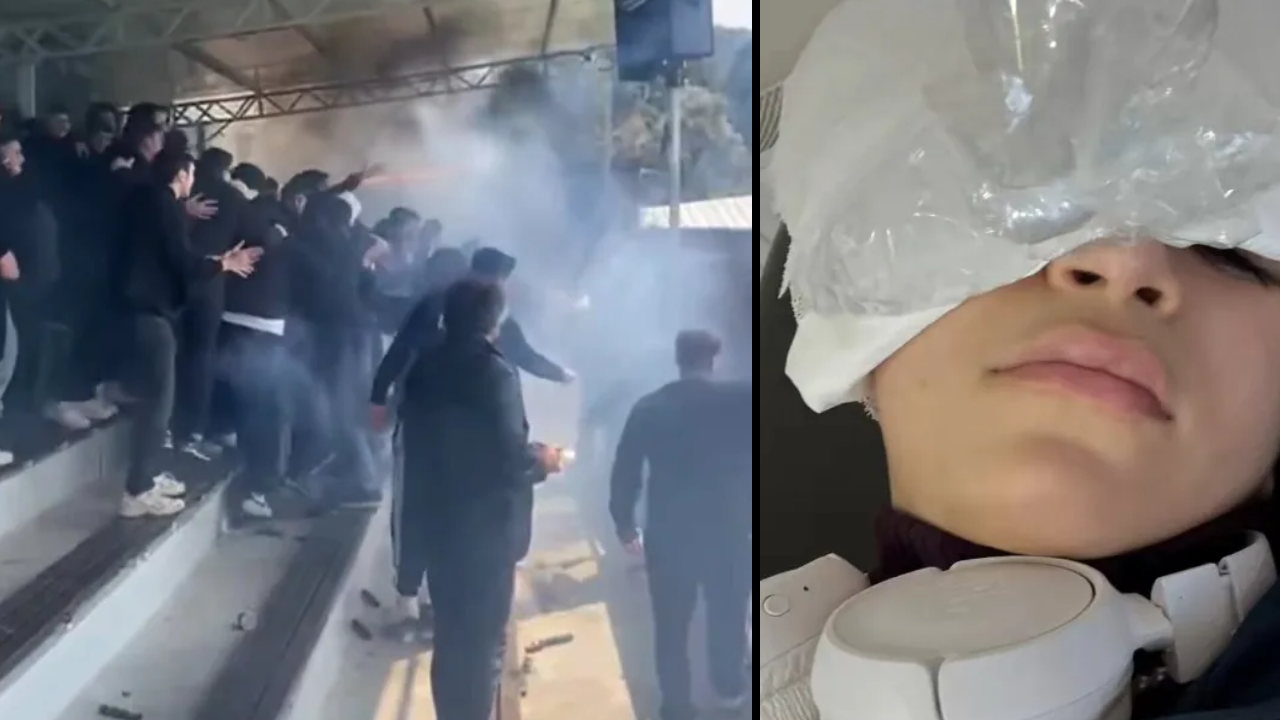 Futbol maçında meşale kabusu: Küçük kızın gözünde hasar oluştu!