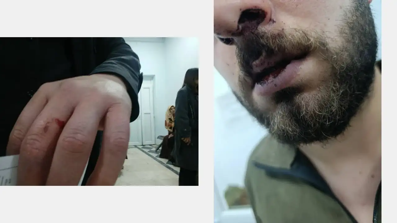 Trafik kuralına uymayan polisi uyaran gençlere işkence: Video çekip şikayetçi oldular