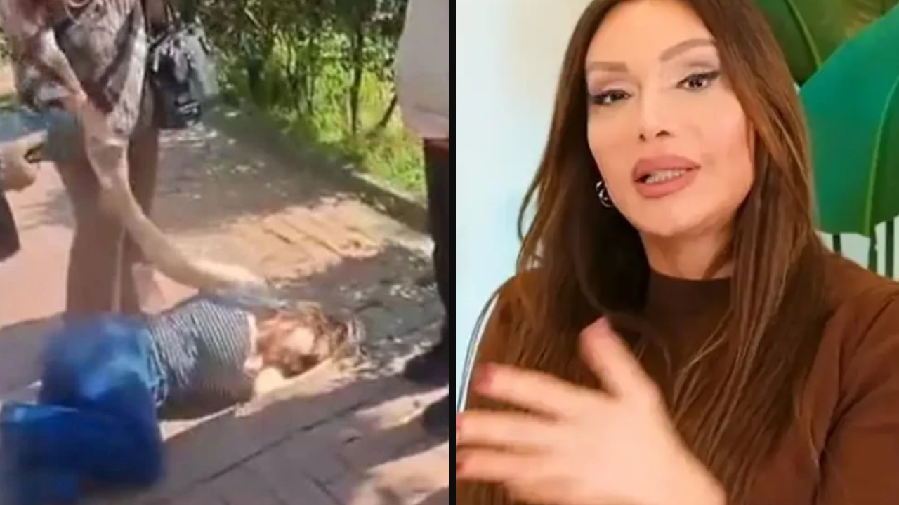 Sevda Demirel’den korkutan kaza: Maçka Parkı’nda ayağını kırdı!