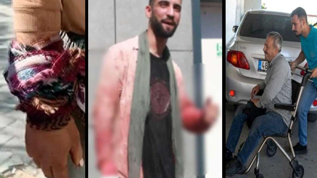 Acemi kasaplar yine hastanelik oldu