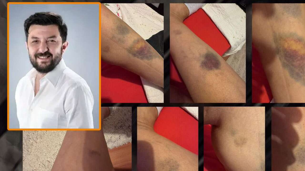 Sevgilisine şiddetten ceza alan AK Parti yöneticisi kapıya konuldu