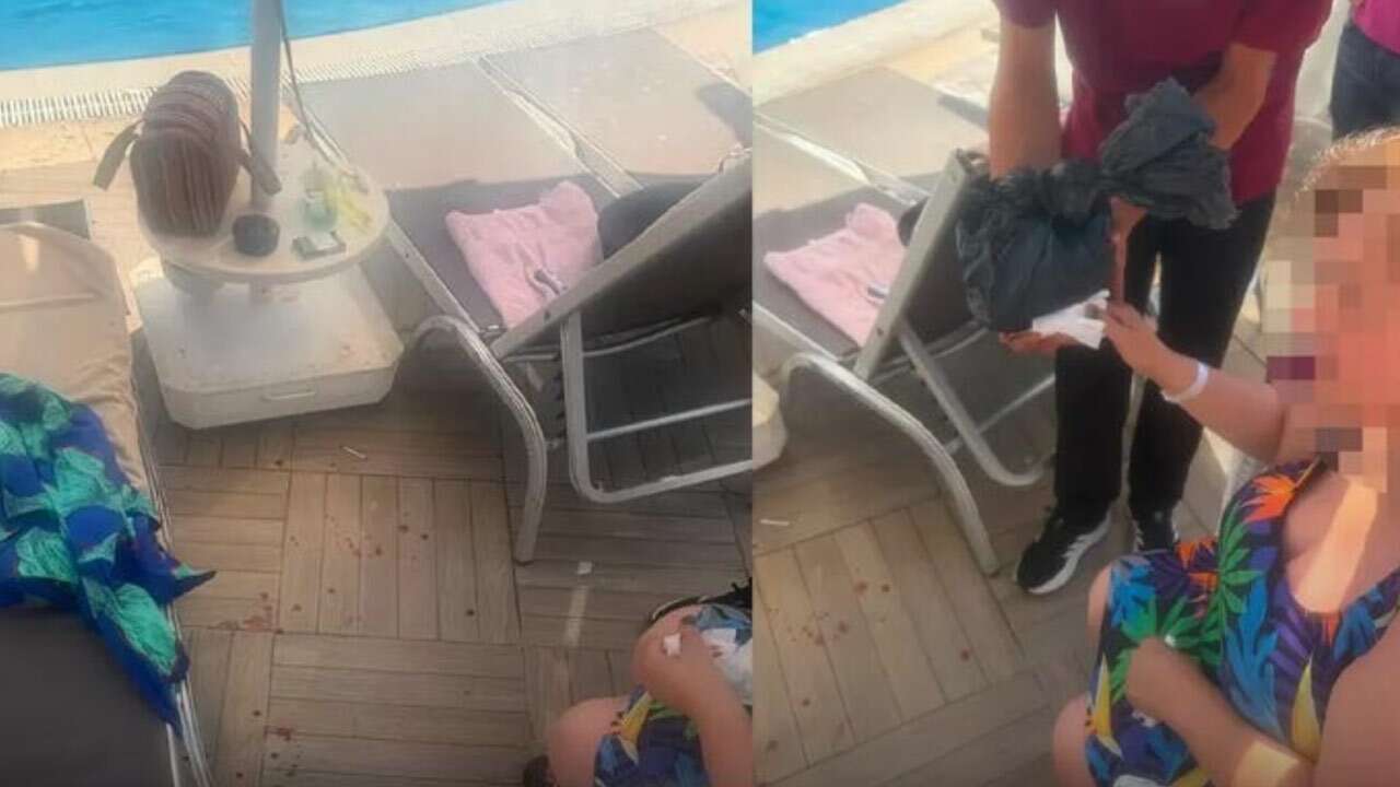 Bodrum’da şezlong parmak kopardı!