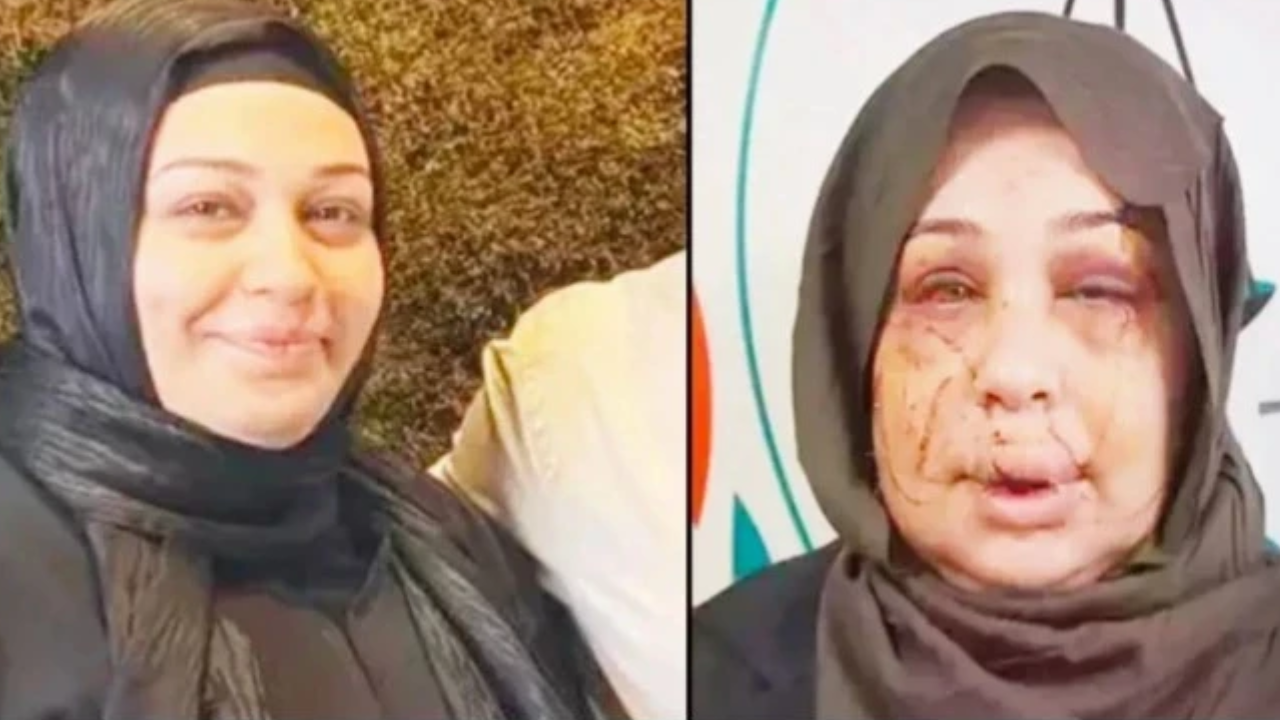 Eşine işkence yapan Cumhurbaşkanı Koruma Dairesi personeline 'iyi hal' indirimi!