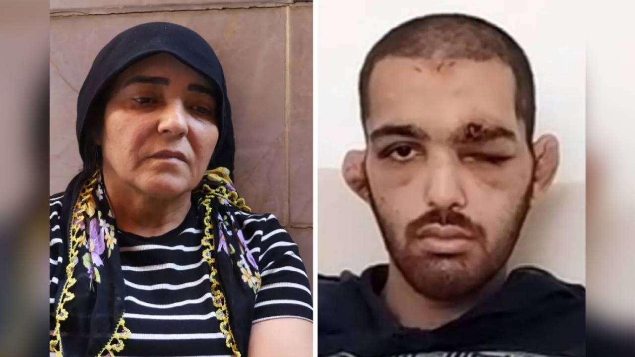 Engelli bakım evinde şüpheli ölüm: Darp izi!