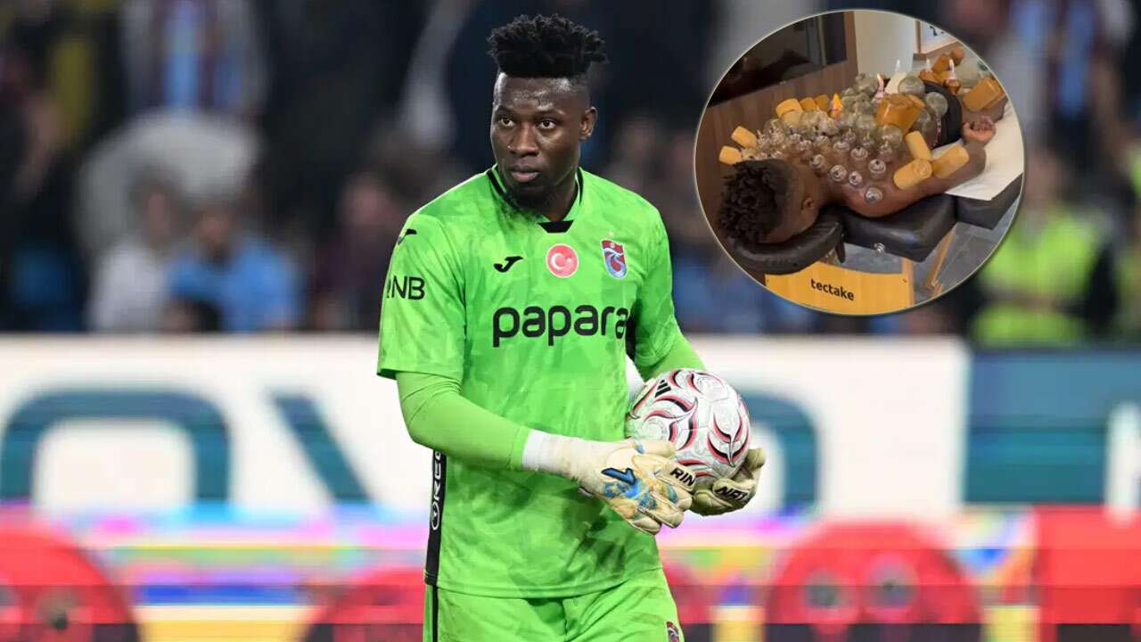 Trabzonspor kalecisi Onana’nın hacamat paylaşımını dünya konuşuyor