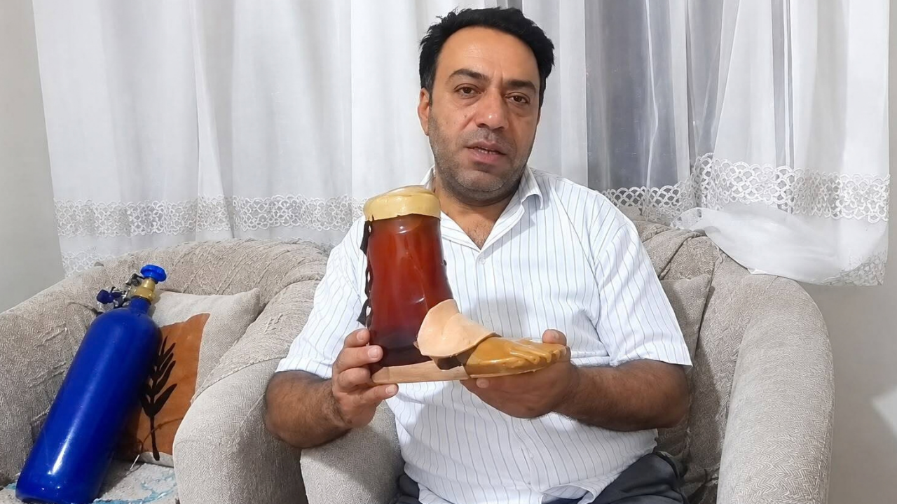 Protez bacak alamayan engelli yurttaş, koli bandıyla tamir ediyor