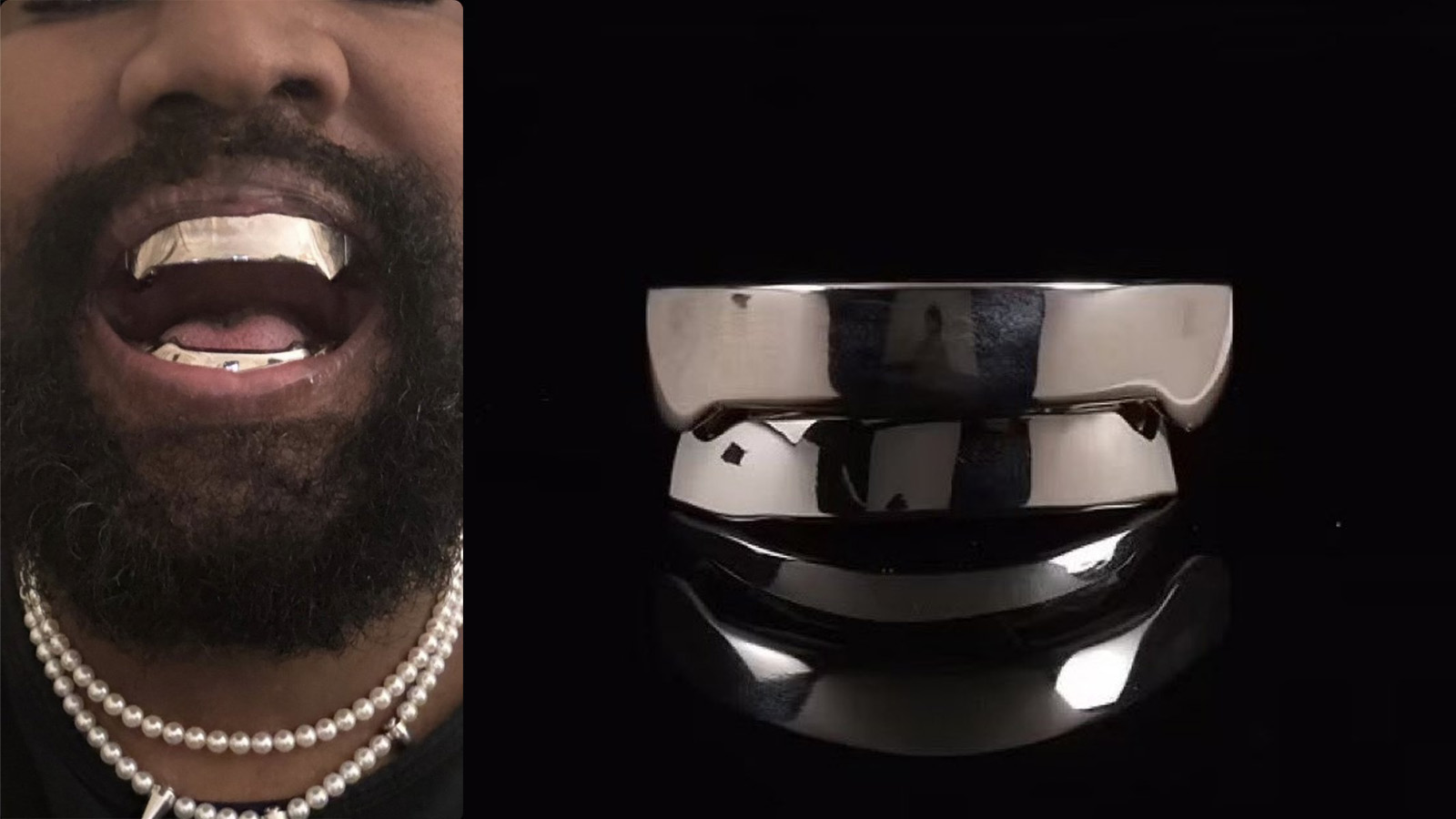 Kanye West tüm dişlerini söktürdü, yerine 'elmastan daha pahalı' protez taktırdı
