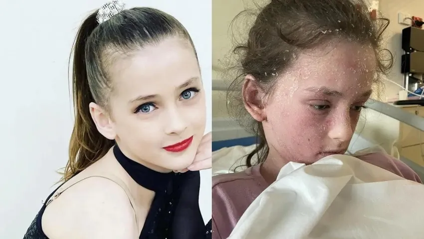 11 yaşındaki kız çocuğunun kendisine alerjisi olduğu ortaya çıktı